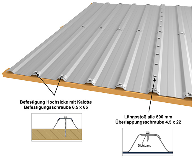 hochsickenbefestigung-m20kd-210-neu
