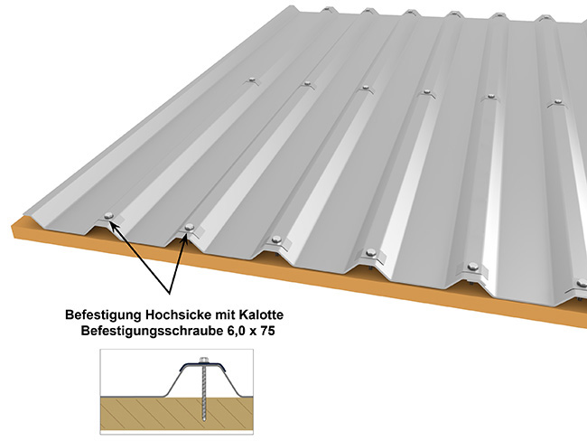 hochsickenbefestigung-m35-1-207-komplettpaket