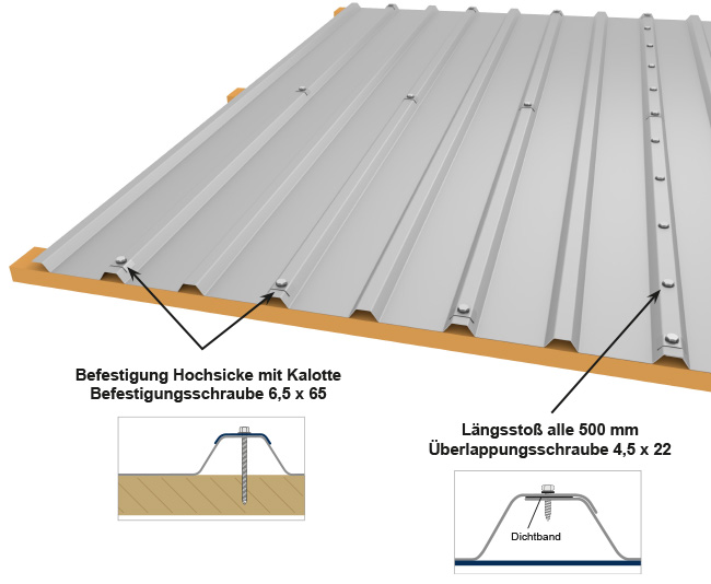Hochsickenbefestigung M 20/154